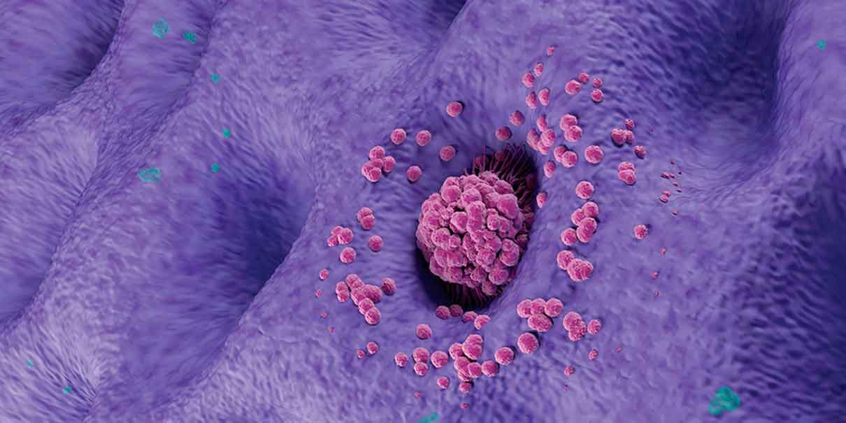 Bacteria H. pylori