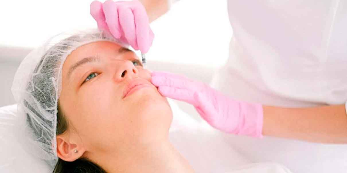 Bótox en jóvenes
