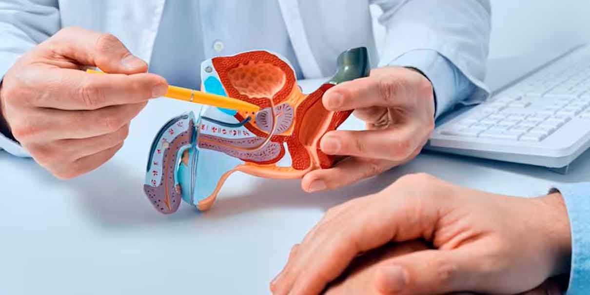 Cáncer de próstata 