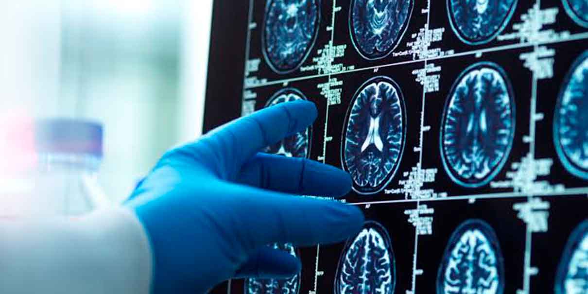  cáncer y el Alzheimer 