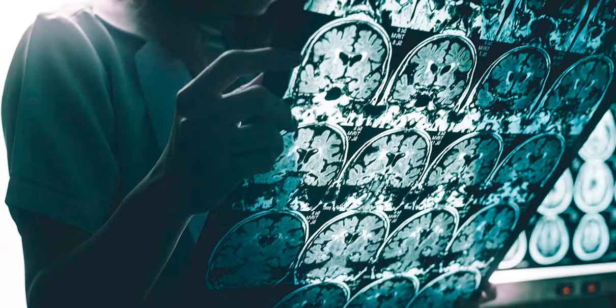 Cerebro