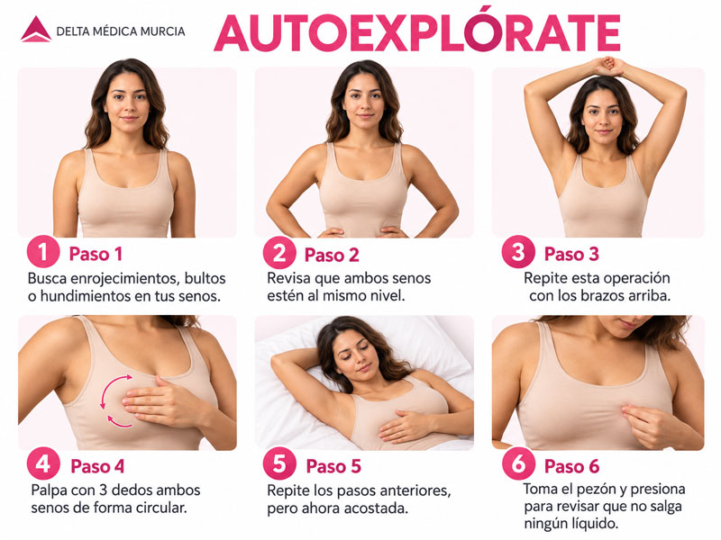 La autoexploración no sustituye la mastografía.