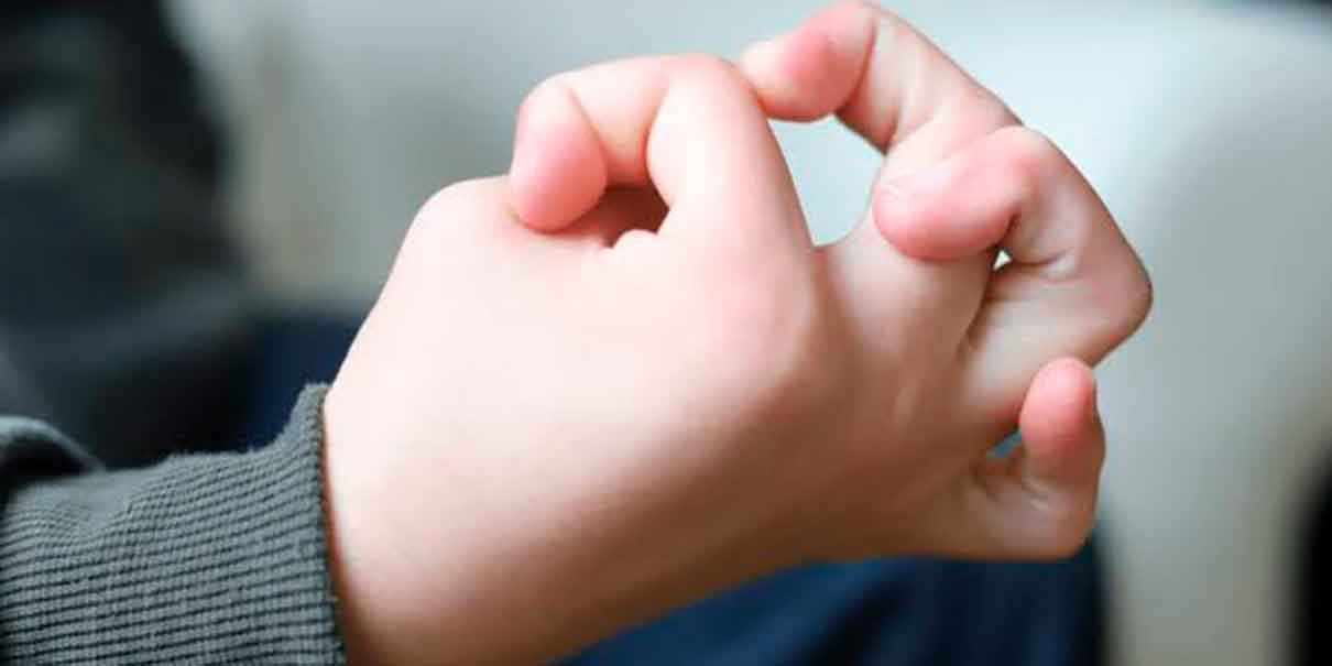 Hipermovilidad articular
