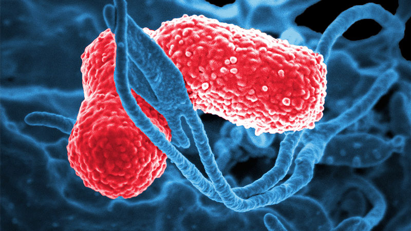 Klebsiella pneumoniae, bacteria que puede causar infecciones graves en pacientes hospitalizados.