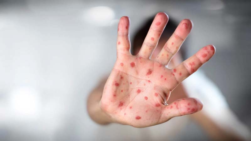 México fabricará vacunas de última generación contra Covid, dengue y cáncer