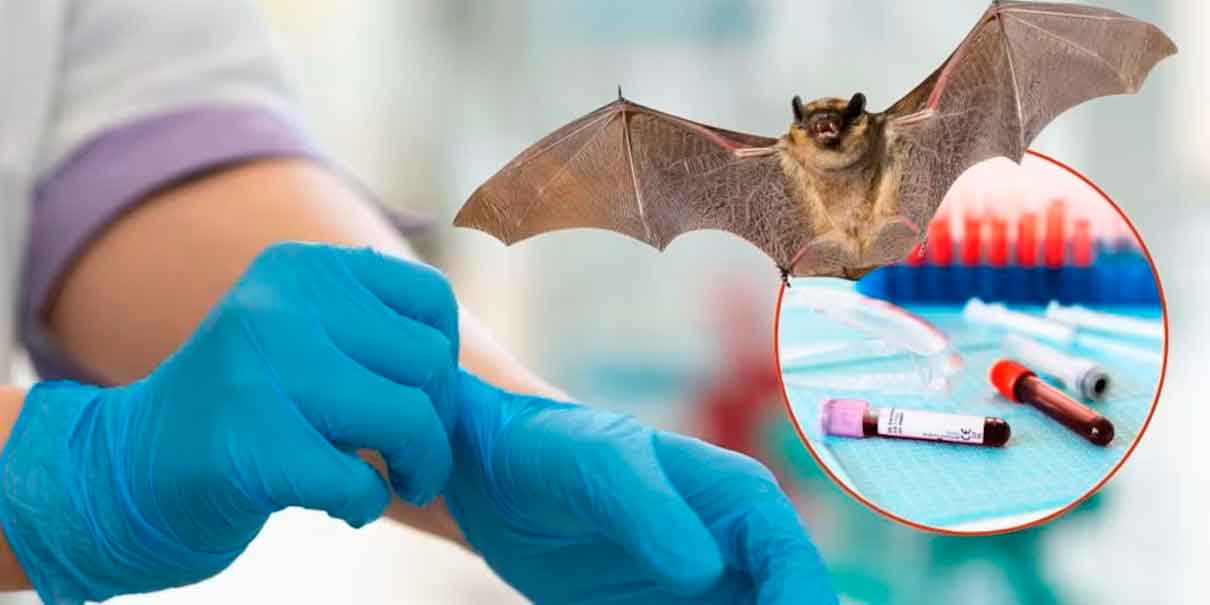 Virus nipah