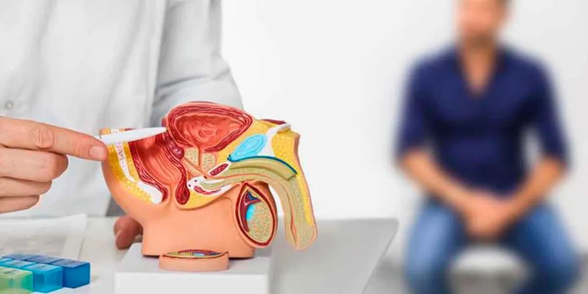 Cáncer de próstata: el hábito alimentario ligado a 30% más riesgo
