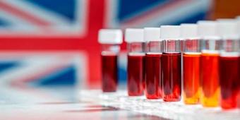 Más de 30 mil pacientes en Reino Unido recibieron sangre contaminada con VIH